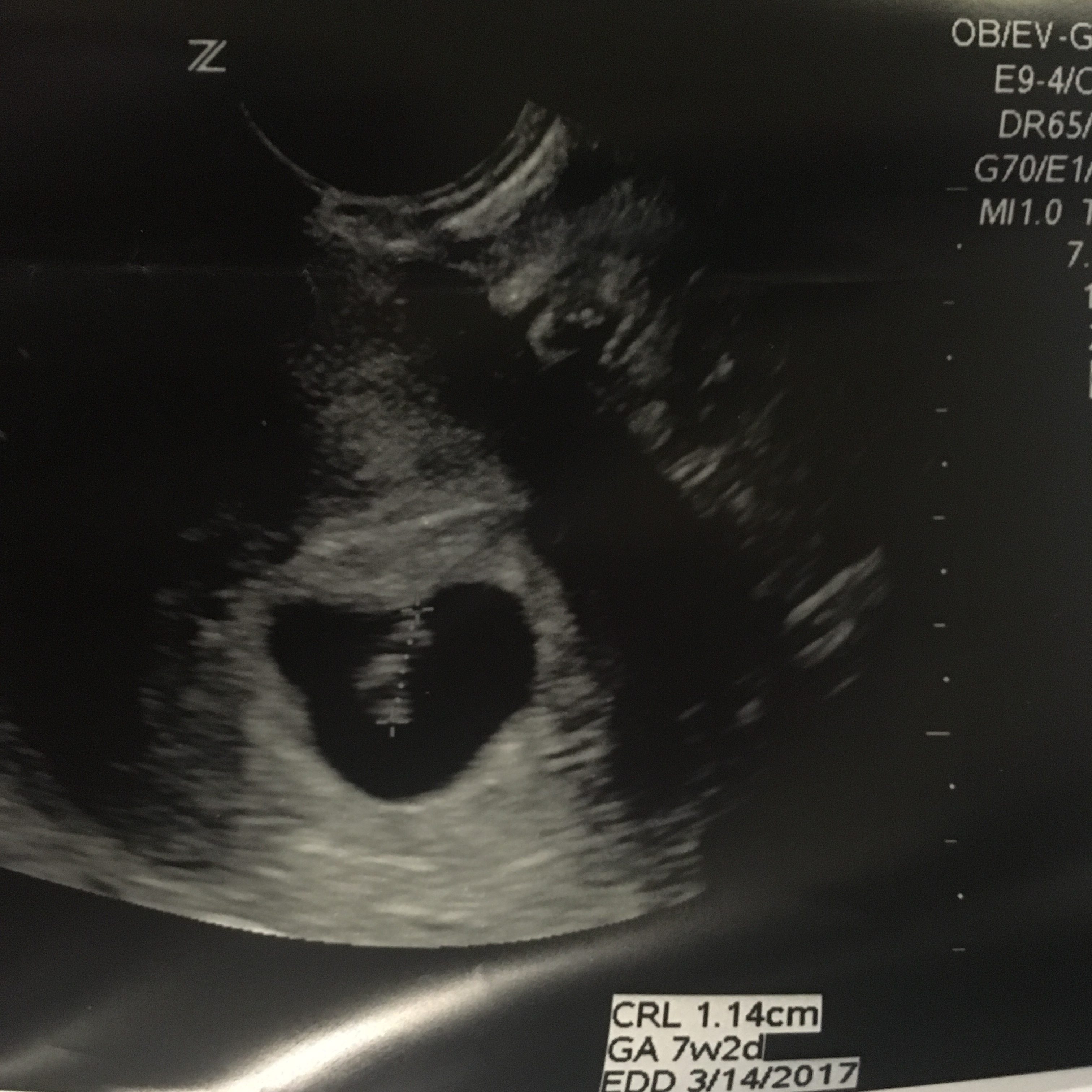 Good News! (A Pregnancy Update)